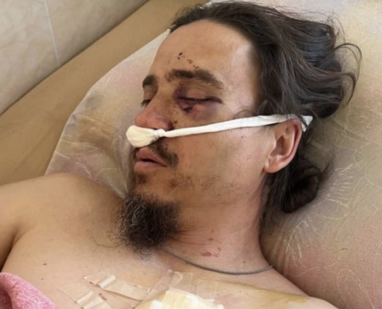 Das Blut der Christen in der Ukraine, das den Deutschen verborgen bleibt фото 2